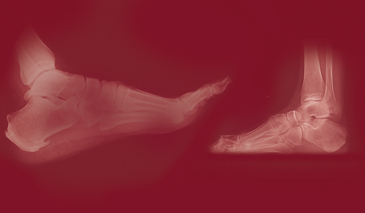 Foot and ankle X-ray imaging at Southwest Foot & Ankle Clinic